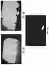 Fig. 16 - Intraoral scanning system with excess material removal based on machine learning