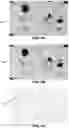 Fig. 11 - Quantitation of signal in stain aggregates
