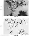 Fig. 13 - Quantitation of signal in stain aggregates