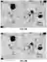 Fig. 15 - Quantitation of signal in stain aggregates