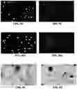 Fig. 17 - Quantitation of signal in stain aggregates