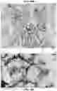 Fig. 19 - Quantitation of signal in stain aggregates