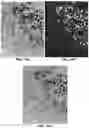 Fig. 23 - Quantitation of signal in stain aggregates