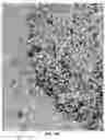 Fig. 26 - Quantitation of signal in stain aggregates