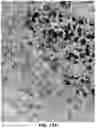 Fig. 27 - Quantitation of signal in stain aggregates