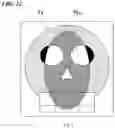 Fig. 13 - Medical image processing device, storage medium, medical device, and treatment system