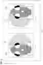 Fig. 14 - Medical image processing device, storage medium, medical device, and treatment system
