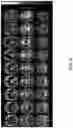 Fig. 05 - Methods and apparatus for detecting injury using multiple types of magnetic resonance imaging data