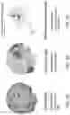Fig. 06 - Methods and apparatus for detecting injury using multiple types of magnetic resonance imaging data