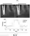 Fig. 08 - Systems and methods for generating multi-view synthetic dental radiographs for intraoral tomosynthesis