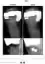 Fig. 09 - Systems and methods for generating multi-view synthetic dental radiographs for intraoral tomosynthesis