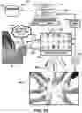 Fig. 11 - Digital launch platform methods and devices