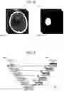 Fig. 13 - Learning image generation device, learning image generation method, learning image generation program, learning method, learning device, and learning program