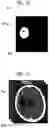 Fig. 14 - Learning image generation device, learning image generation method, learning image generation program, learning method, learning device, and learning program