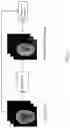 Fig. 05 - An Auxiliary Diagnostic Model and an Image Processing Method for Detecting Acute Ischemic Stroke