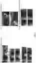 Fig. 08 - Appearance based dominant eye selector systems and methods for gaze estimation from passive imagery
