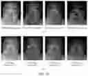 Fig. 08 - Face liveness detection method and related apparatus