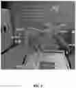 Fig. 10 - MEDICAL VIRTUAL REALITY SURGICAL SYSTEM