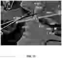 Fig. 14 - MEDICAL VIRTUAL REALITY SURGICAL SYSTEM