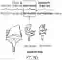 Fig. 15 - Use of robotic surgical data for training