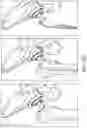 Fig. 34 - Use of robotic surgical data for training