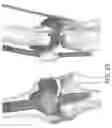 Fig. 43 - Use of robotic surgical data for training