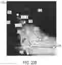 Fig. 48 - Use of robotic surgical data for training