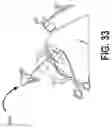 Fig. 61 - Use of robotic surgical data for training