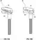 Fig. 11 - Resonator accessories for musical instruments