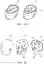 Fig. 06 - Contouring system