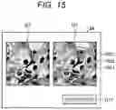 Fig. 16 - Diagnosis support program, diagnosis support system, and diagnosis support method