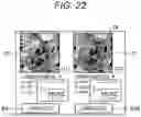 Fig. 21 - Diagnosis support program, diagnosis support system, and diagnosis support method