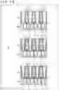 Fig. 49 - Light detecting element and method of manufacturing same