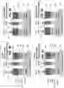 Fig. 05 - Simultaneous dual-band image sensors