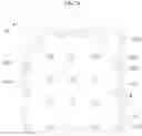 Fig. 10 - Vertical light-emitting diode