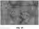 Fig. 04 - HIGH CAPACITY BATTERY ELECTRODE STRUCTURES