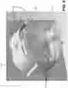 Fig. 10 - Tool for treating a seal wiping surface of a sealed connector