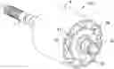Fig. 01 - ROTOR FOR AN ELECTRIC MACHINE, HAVING IMPROVED AXIAL LOCKING OF A LAMINATED ROTOR CORE