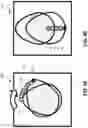 Fig. 06 - Synchronous head movement (SHMOV) detection systems and methods