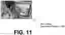 Fig. 15 - System and method for image stitching