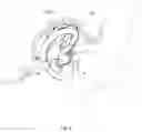 Fig. 08 - Retaining member for earpiece of hearing device