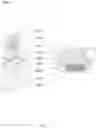 Fig. 35 - Bone conduction speaker