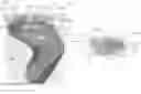 Fig. 01 - Hearing aid for placement in a user's ear canal