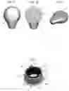 Fig. 02 - Concept for attaching a sound processor to the head via an interchangeable magnet