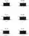 Fig. 04 - Concept for attaching a sound processor to the head via an interchangeable magnet