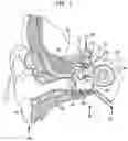 Fig. 02 - TRANSDUCER PLACEMENT FOR GROWTH ACCOMMODATION