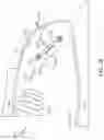 Fig. 37 - Piezoelectric transducer for tympanic membrane