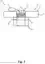 Fig. 04 - Hearing device with two microphone filters