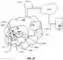 Fig. 24 - Early measurement reporting with RRC resume request message and indication of request for early measurements in association with paging
