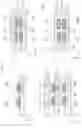 Fig. 04 - Resin multilayer substrate and method for manufacturing resin multilayer substrate